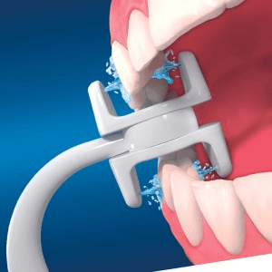 Miracle Smile : Un Sourire Éclatant